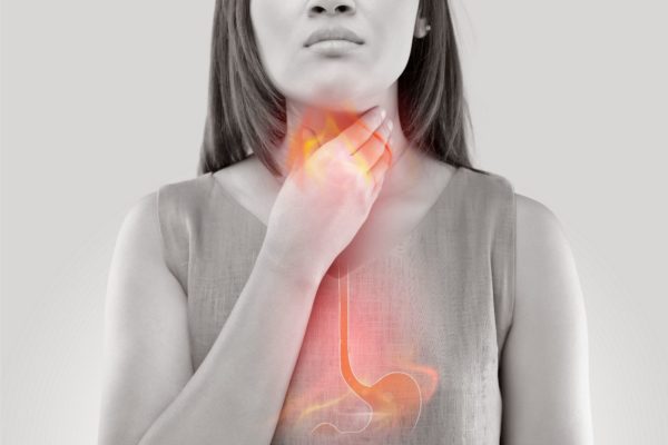 gastroesophogeal reflux disease northern california research